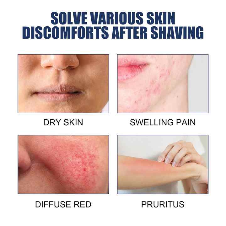 Smooth Skin Aftershave Serum™