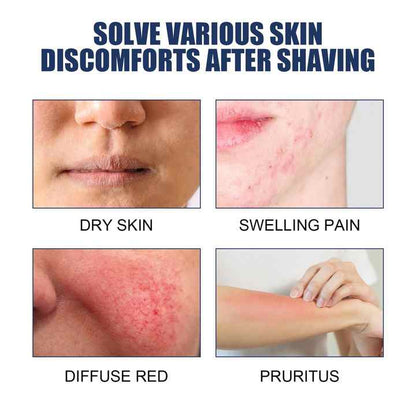 Smooth Skin Aftershave Serum™
