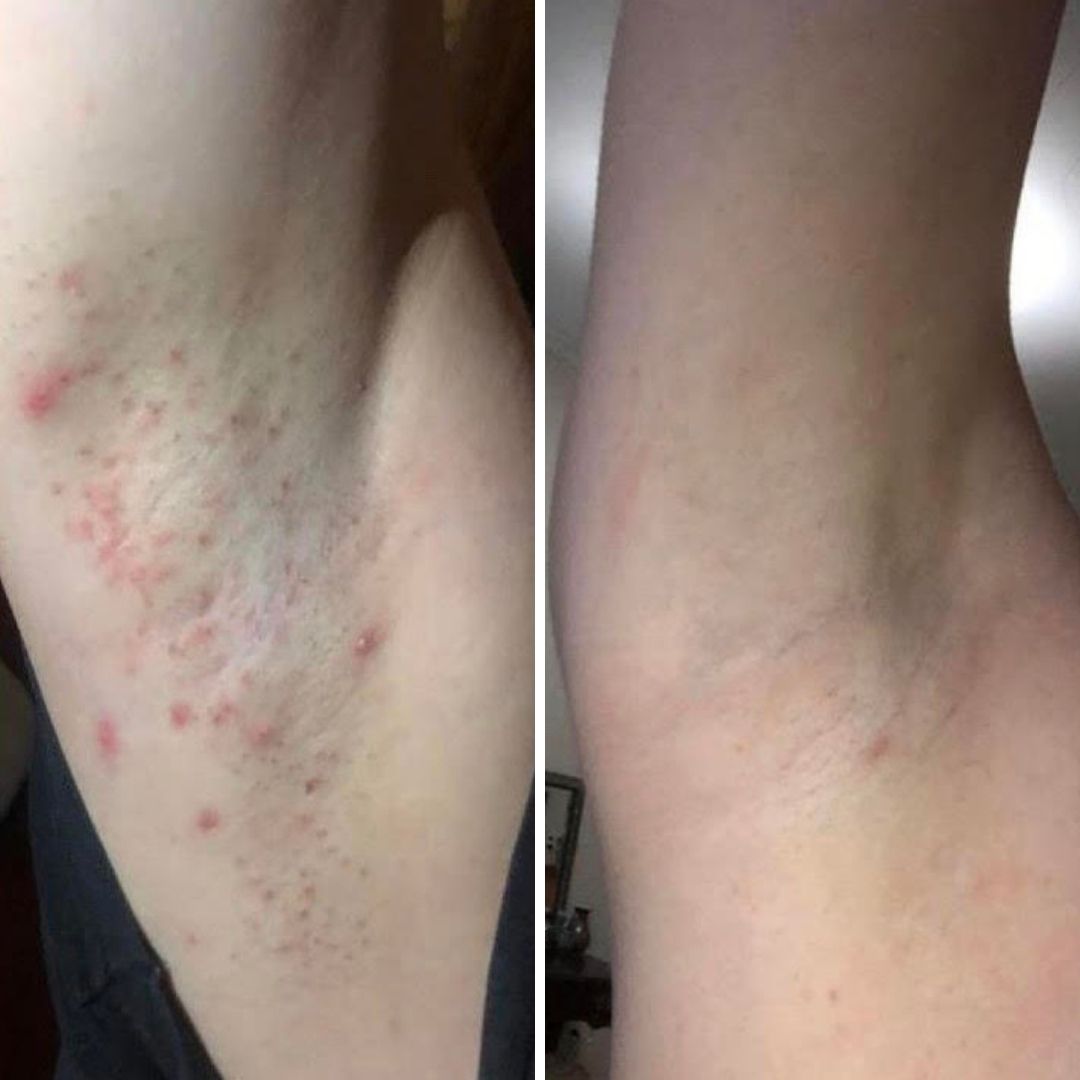 Smooth Skin Aftershave Serum™