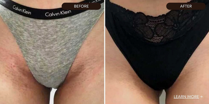 Smooth Skin Aftershave Serum™